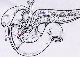 為什么會胃下垂？具體原因是什么？